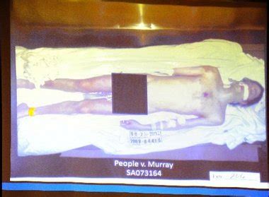 michael jackson autopsy photo|Shocking photo of a dead Michael Jackson shown to jury